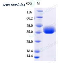 Sino Biological 40592-V08H161 image 1