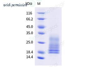 Sino Biological 40886-V49H-B image 1