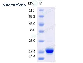 Sino Biological 40889-V44E-B image 1
