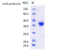 Sino Biological 41040-V49H-B image 1