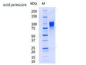 Sino Biological 5A2410-M02H-UE image 1