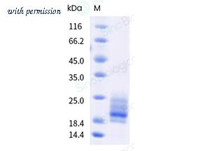 Sino Biological 80461-R07H image 1