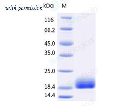 Sino Biological 10282-HNCE-B image 1