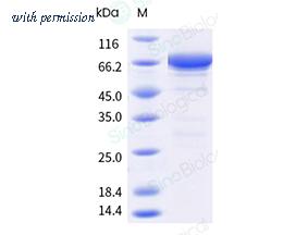 Sino Biological 10795-H09B-B image 1