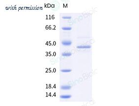 Sino Biological 11007-H73H-NB-B image 1