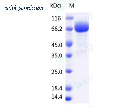 Sino Biological 11946-H01H image 1