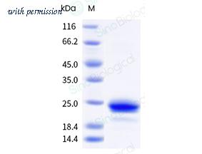 Sino Biological 12225-H07H image 1