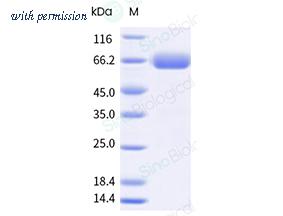 Sino Biological 13320-H02H-B image 1