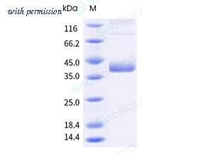 Sino Biological 13921-HNCB-B image 1