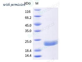 Sino Biological 14547-HNCB-B image 1