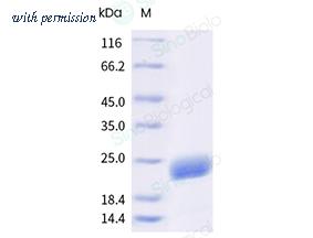 Sino Biological 16122-HNCE-B image 1