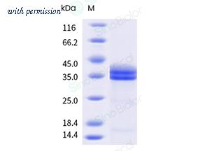 Sino Biological 10157-HNCH image 1
