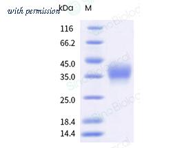 Sino Biological 10229-H49H-B image 1