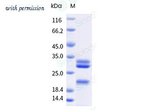 Sino Biological 10416-H08H-A image 1