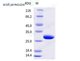 Sino Biological 10741-H08E image 1
