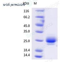 Sino Biological 11159-H49H1-B image 1
