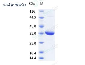 Sino Biological 12054-HNCE image 1