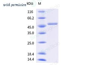 Sino Biological 12939-H09E-B image 1