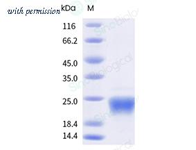 Sino Biological 13205-HNCE-B image 1