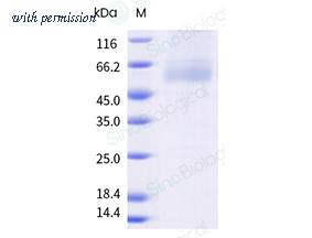 Sino Biological 22274-H102H-DD-B image 1