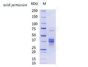 Sino Biological CT177-CNAH-UE image 1