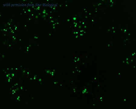 Sino Biological HG12121-ACG image 1