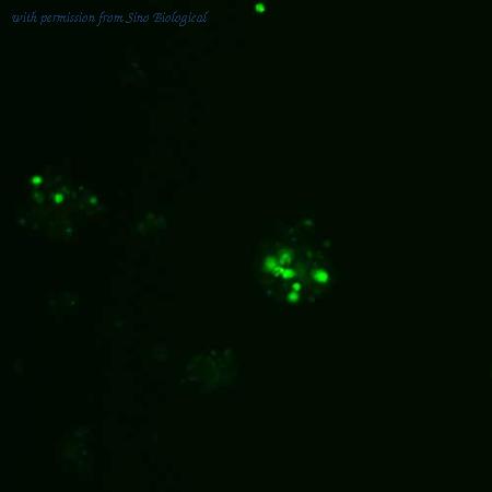 Sino Biological HG11664-ACG image 1