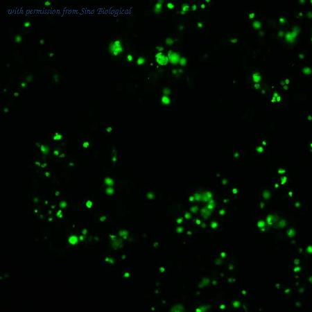 Sino Biological HG11473-ACG image 1