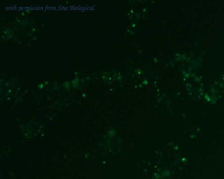 Sino Biological HG11420-ACG image 1