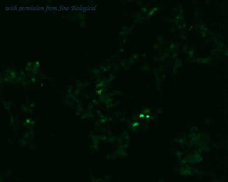 Sino Biological HG11019-ACG image 1