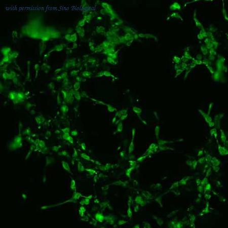 Sino Biological HG10215-CF image 1