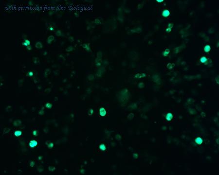 Sino Biological HG15847-ACG image 1