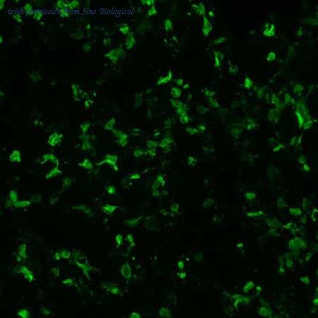 Sino Biological HG13867-CF image 1