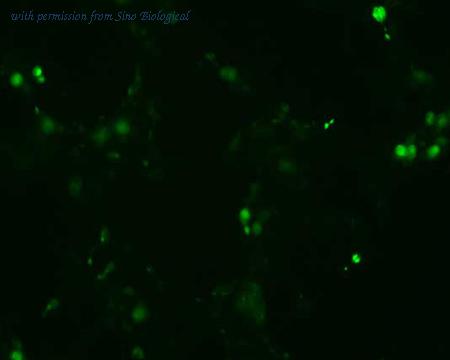 Sino Biological HG13416-CF image 1