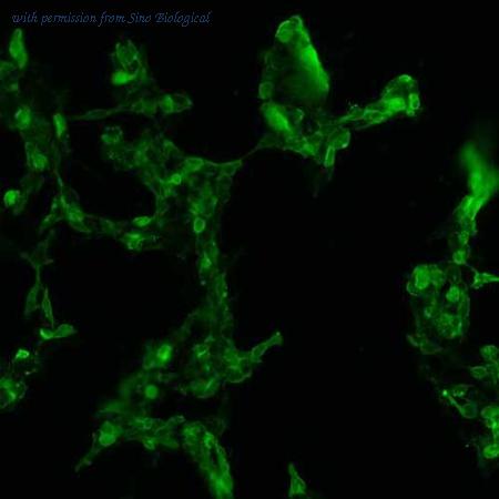 Sino Biological HG13320-CF image 1