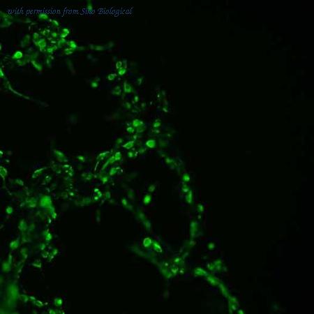 Sino Biological HG13271-CF image 1