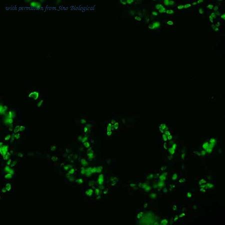Sino Biological HG13131-CF image 1
