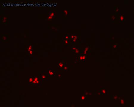 Sino Biological HG11682-ACR image 1