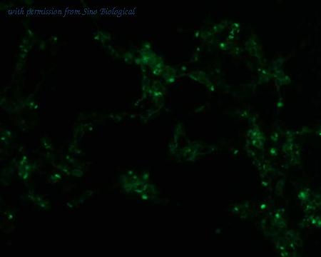 Sino Biological HG11674-ACG image 1