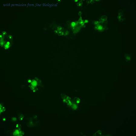 Sino Biological HG11657-ACG image 1