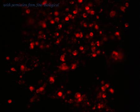 Sino Biological HG11612-ACR image 1
