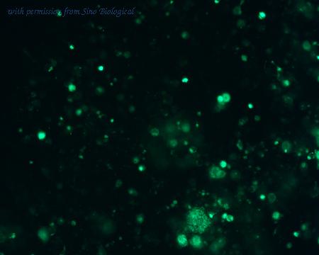Sino Biological HG11606-ACG image 1
