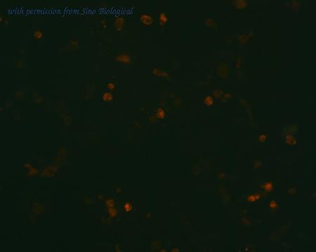 Sino Biological HG11605-CF image 1