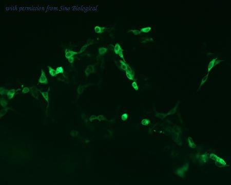 Sino Biological HG11604-CF image 1