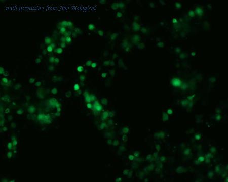 Sino Biological HG11544-ACG image 1