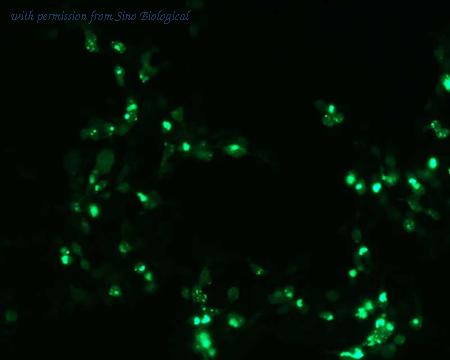 Sino Biological HG11488-ACG image 1
