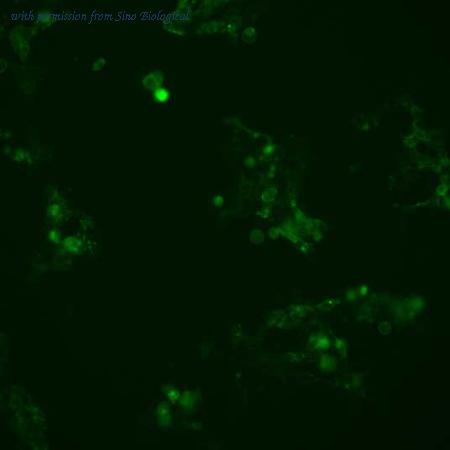 Sino Biological HG11477-ACG image 1