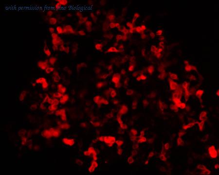 Sino Biological HG11430-ACR image 1