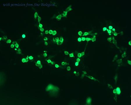 Sino Biological HG11429-NF image 1
