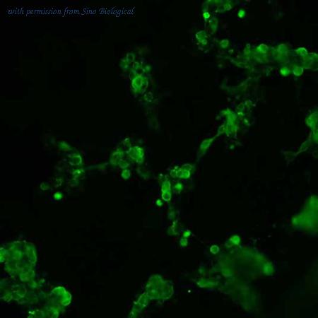 Sino Biological HG11429-CF image 1